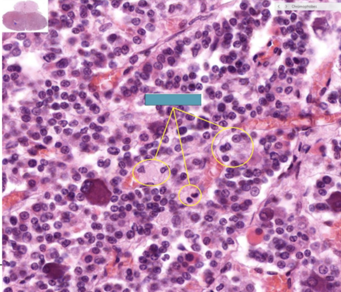 <p>Identify the cells</p>
