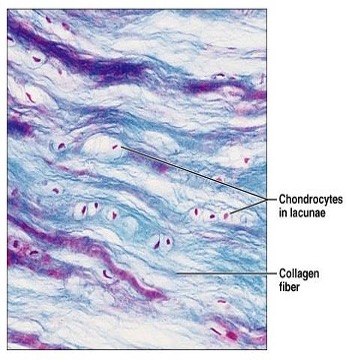 <p><strong>Identify the tissue. State its function and location.</strong></p>