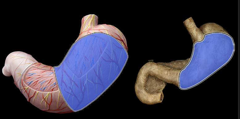 term image