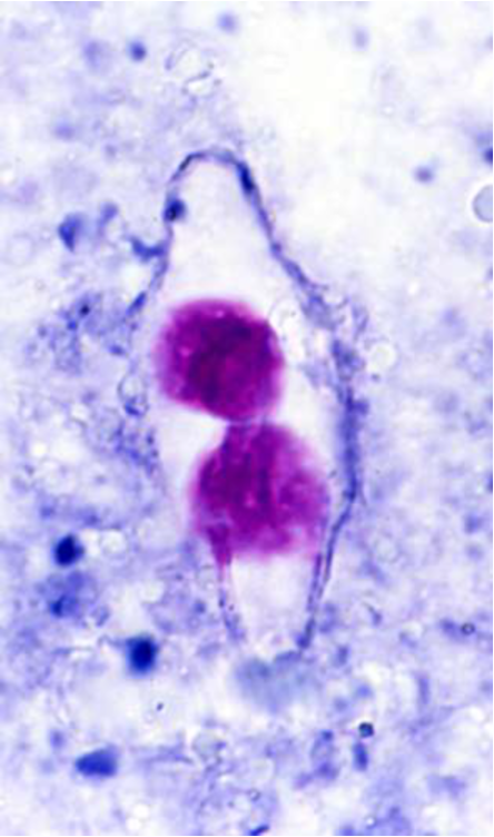 <p><span>Modified acid-fast stain</span></p>