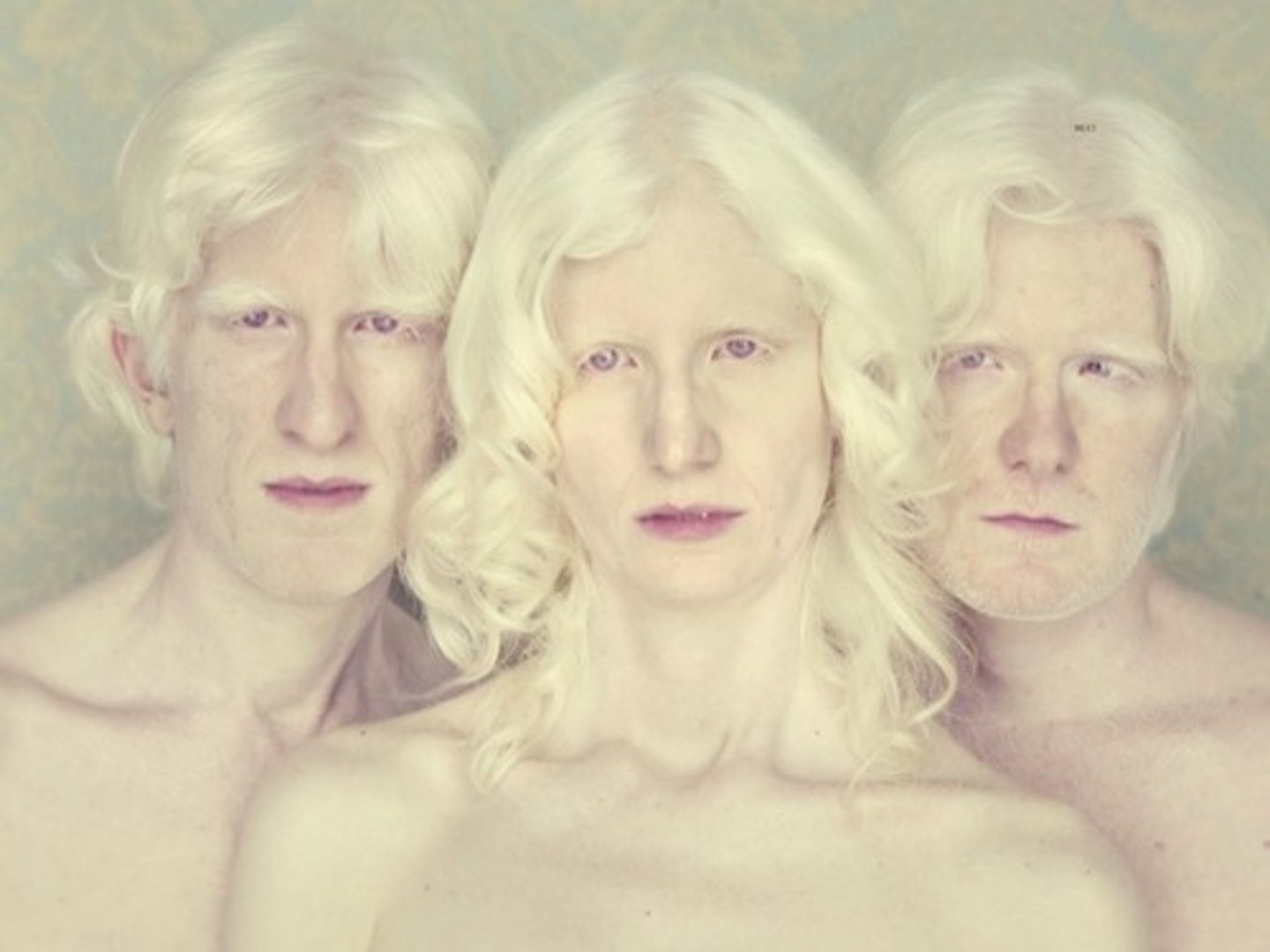 <p>Absence of pigment in the skin, hair, and eyes</p>