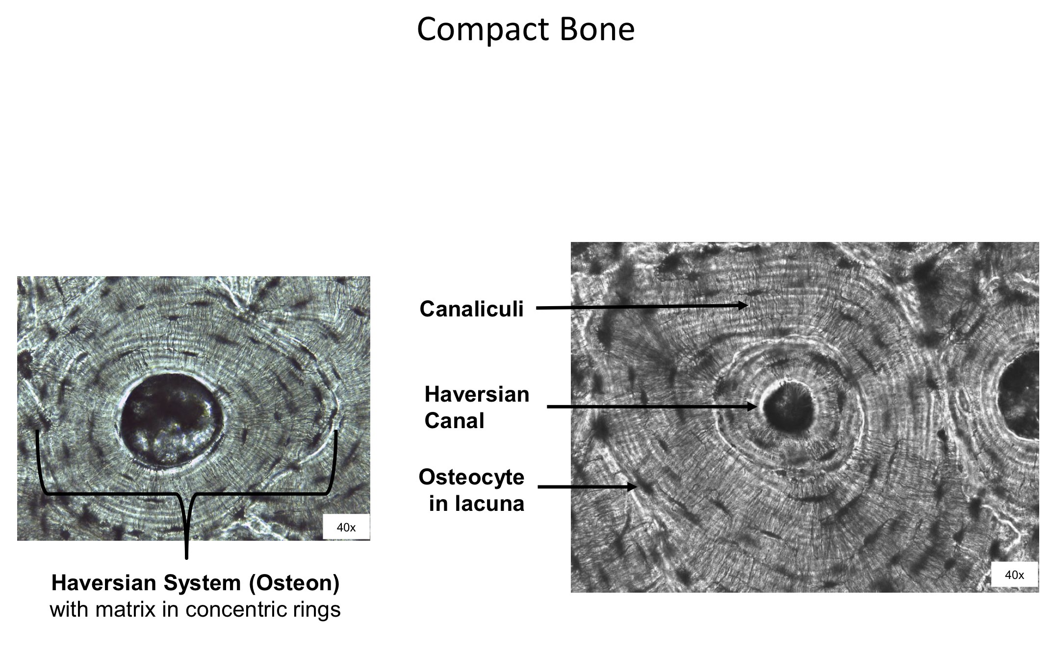 <ol><li><p>Canaliculi </p></li><li><p>Haversian canal </p></li><li><p>Osteocyte in lacuna </p></li></ol><p></p>
