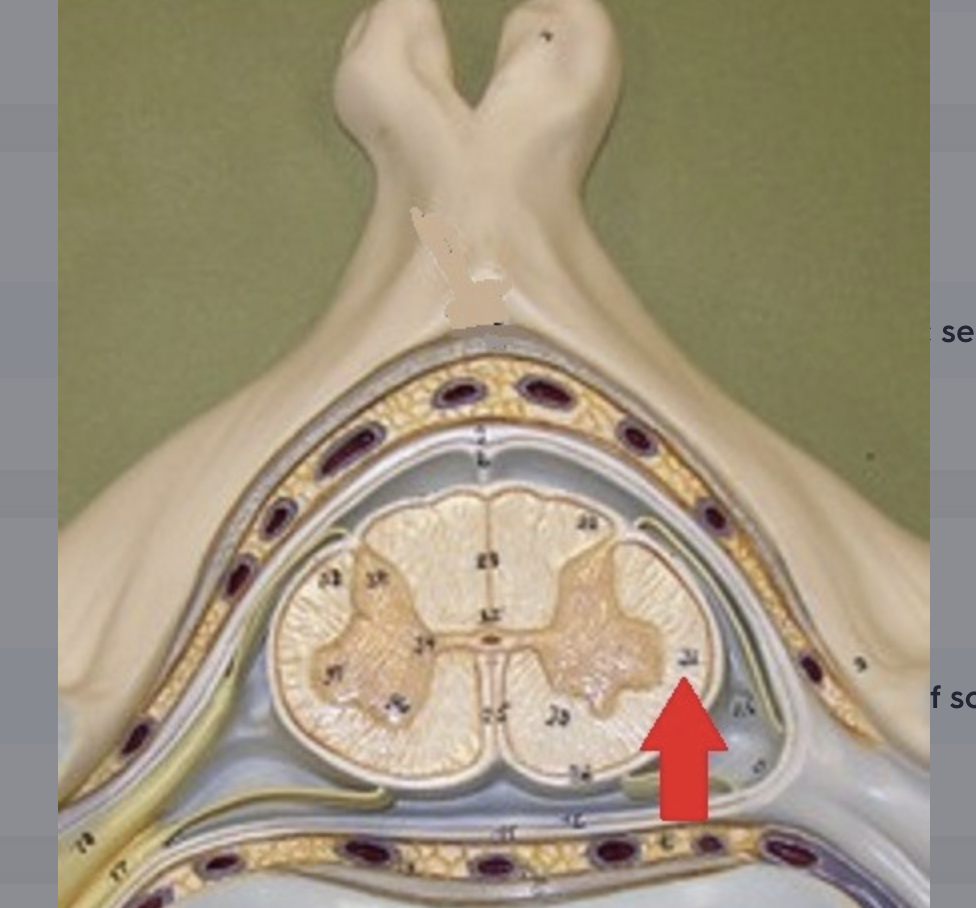 <p>location of spinocerebellar tracts (for “unconscious” proprioception), lateral spinothalamic tract (for pain and temperature sensations), lateral corticospinal tract (for conscious motor commands), lateral pathway tracts (for subconscious and reflexive motor control)</p>