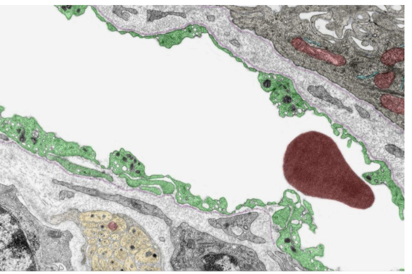 <p>Identify the vessel </p>