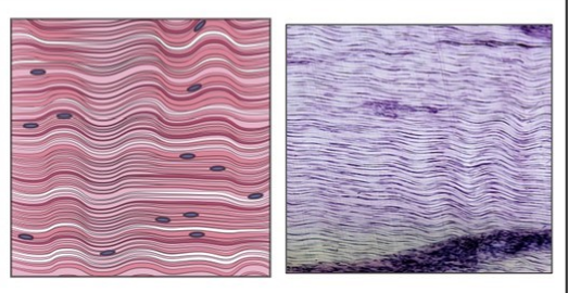 <p>dense CT that has closely packed, parallel collagen fibers; strong when pulled in one direction</p>