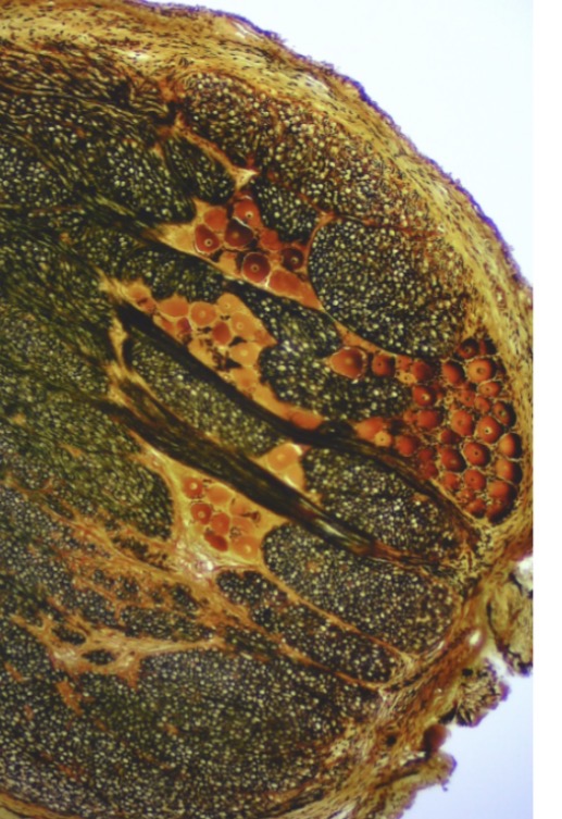 <p>What type of tissue?</p>