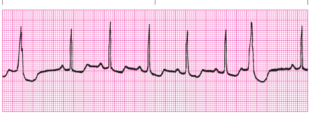 <ol><li><p>Regularity?</p></li><li><p>Rate</p></li><li><p>P Waves</p></li><li><p>PRI</p></li><li><p>QRS</p></li><li><p>Interpretation</p></li></ol><p></p>