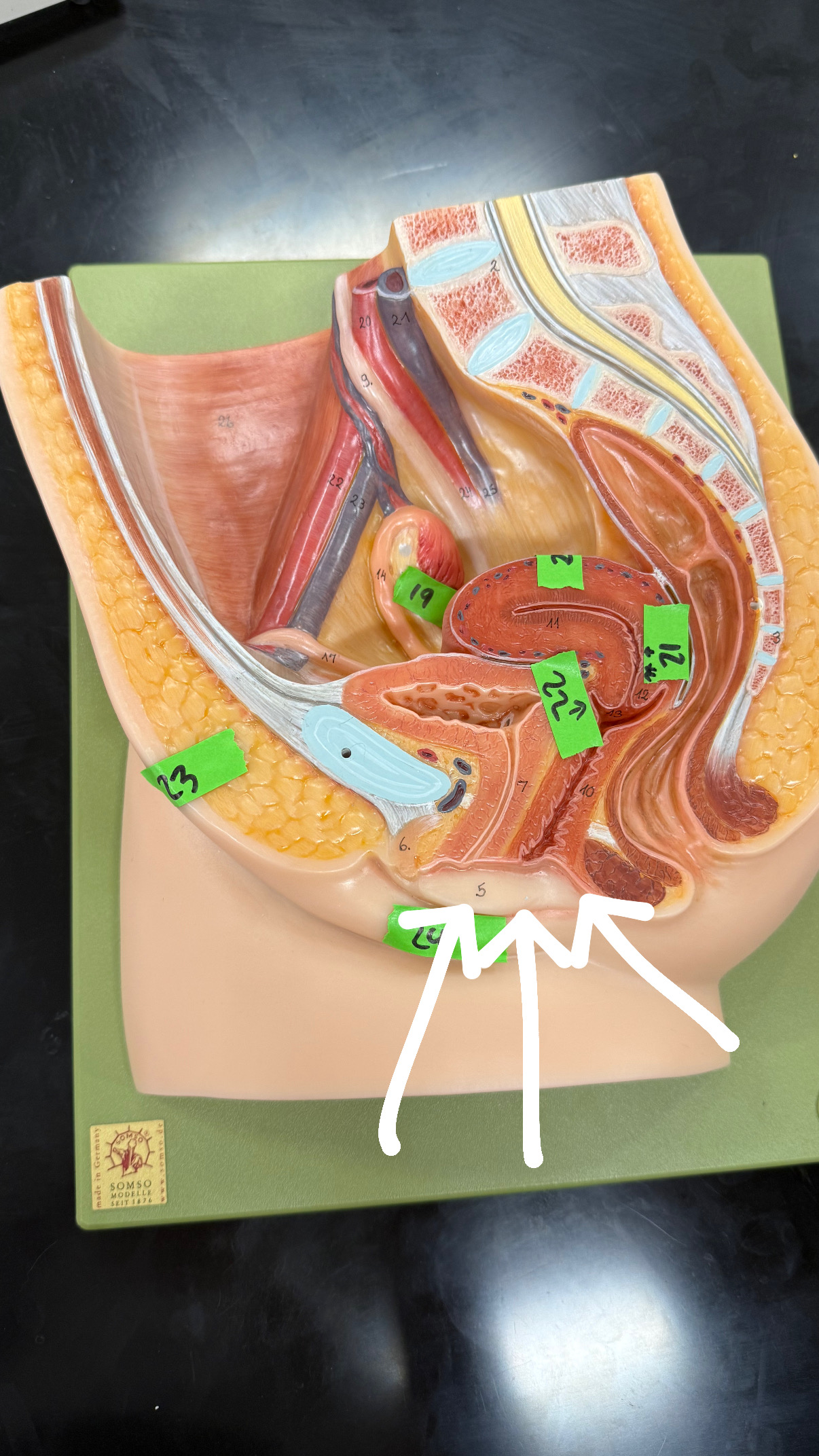 <p>under clitoris</p>