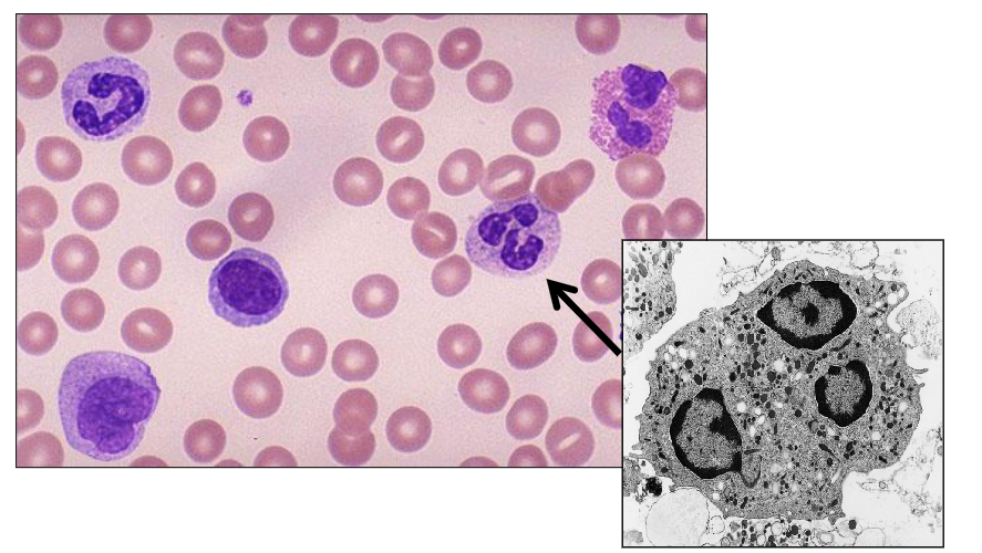 <p>a) Neutrophils</p>
