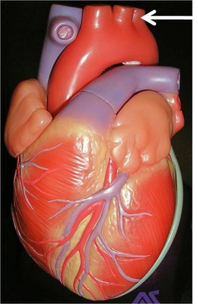 <p>Third branch of the aortic arch that distributes blood to the left arm</p>