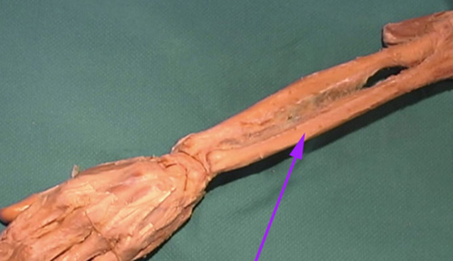 <p>What is the name of this bone that is indicated by the arrow?</p>