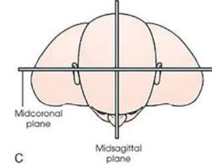 <p>Runs front to back. Parallel to IR because patient is rotated 90*</p>