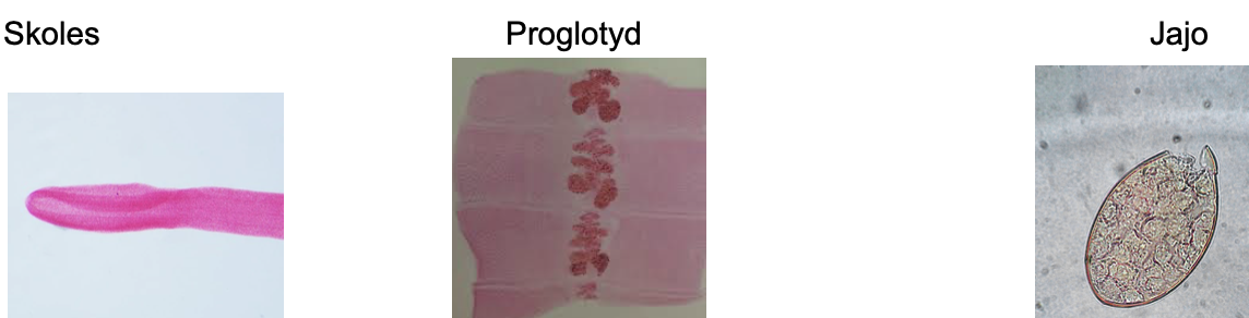 <p><strong>Diphyllobothrium latum</strong> – skoleks z bruzdami czepnymi (nie przyssawkami!), proglotydy szerokie, jaja z wieczkiem i guziczkiem.</p>