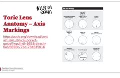 <p>Toric Lens Anatomy -- Axis Markings (Pic)</p>