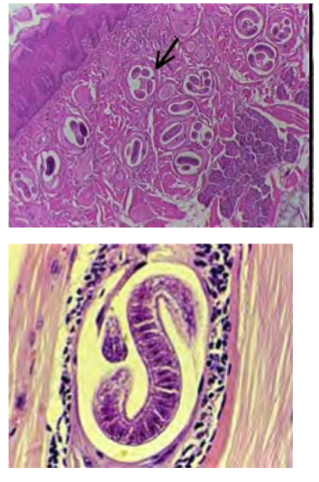 <p>a group of nematodes</p><p>mammalian and reptilian parasites</p><p>cysts live in muscle tissue (hatch when eaten by new host, young worms burrow through intestinal wall and muscles. Sometimes enter CNS)</p><p>cause trichinosis </p><p>symptoms: cramping, diarrhea, fever</p><p>in US, ~12 cases per year (reduced by not allowing the feeding of raw meat to hogs)</p>