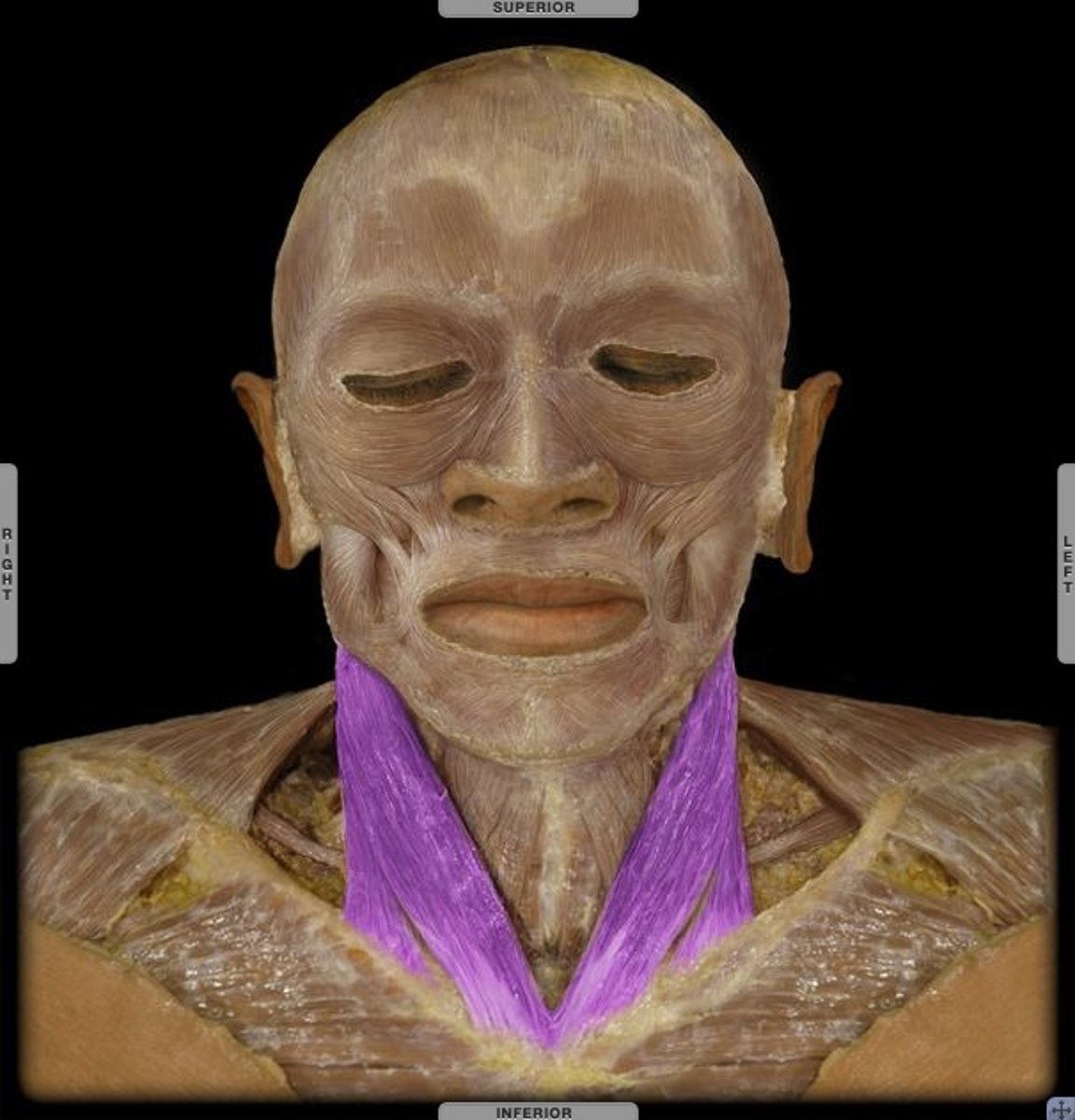 <p>Origin: the sternal manubrium and medial clavicle, Insertion onto the mastoid process and superior nuchal line.</p>