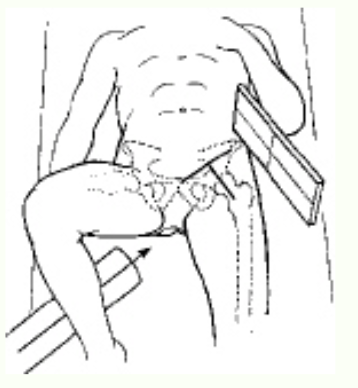 <p>Which projection of the hip is shown in the figure above?</p>