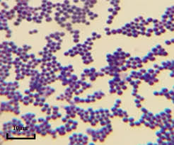 <ul><li><p>spherical bacteria shape that can be presented in chains, clusters(diploid, tetrads, many)</p></li><li><p>Not motile —> no flagella</p></li></ul><p></p>