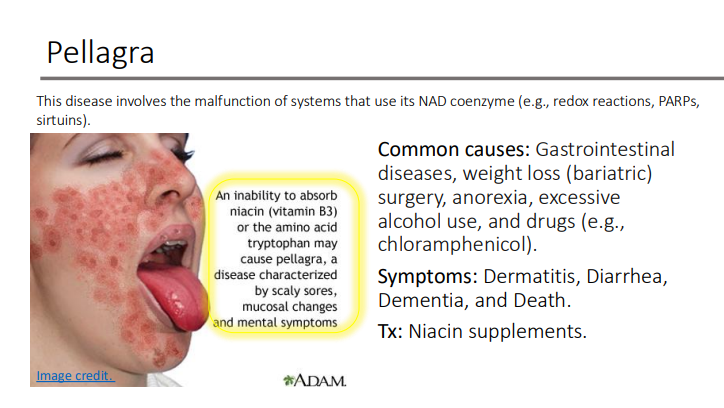 <p><strong>Symptoms</strong>: Dermatitis, Diarrhea, Dementia, and Death. </p><p><strong>Tx</strong>: Niacin supplements.</p>