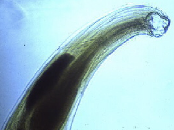 <p>What nematode/roundworm/parasitic worm mouth is this?</p>