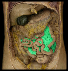 <p>double layer of peritoneum</p>