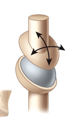 <p>what type of joint is this?</p>