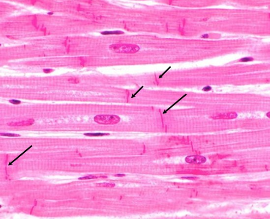 <p>El musculo cardiaco debe contraerse de manera sincronizada para bombear, están conectadas mediante estructuras especializadas que permiten la transmisión rápida de señales eléctricas y adhesión mecánica entre cardiomiocitos, ¿Cómo se denomina la estructura responsable de la comunicación de tejido cardiaco?</p>