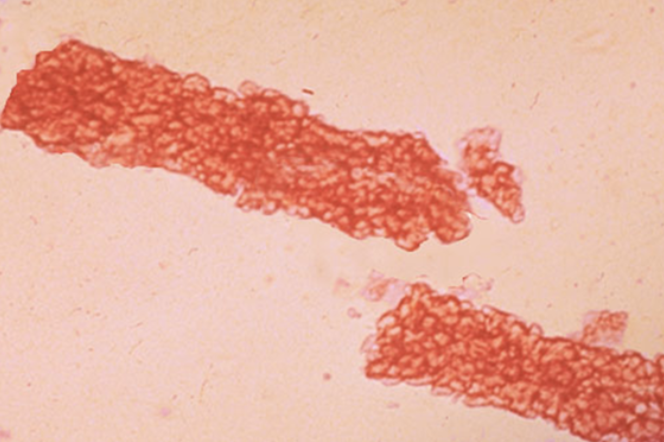 <p>Identify the following.</p>