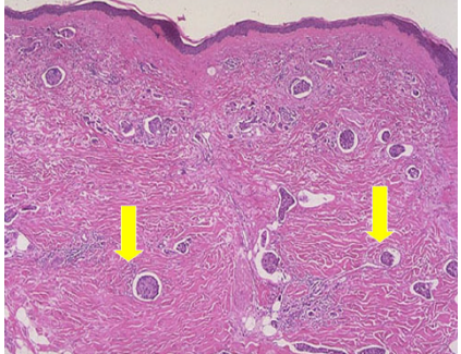 <p>What pathology?</p>