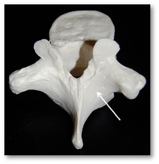 <p>Name this bony landmark of the vertebra.</p>