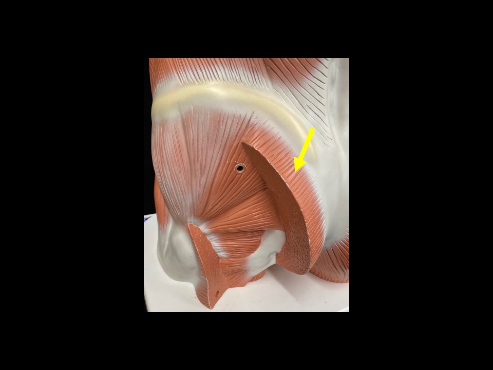 <p>Name the muscle </p>