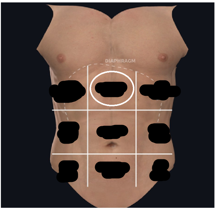<ul><li><p><span style="background-color: transparent;">Superior the umbilical region</span></p></li><li><p><span style="background-color: transparent;">Above the stomach</span></p></li></ul><p></p>