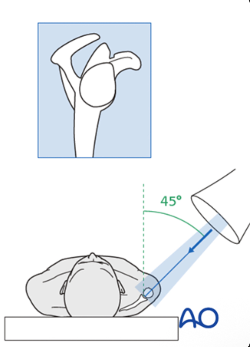 <p>45 degrees</p>