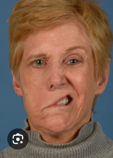 <p>What you diagnose this person with?</p>