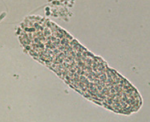 <p>Disintegration of Cellular casts</p>