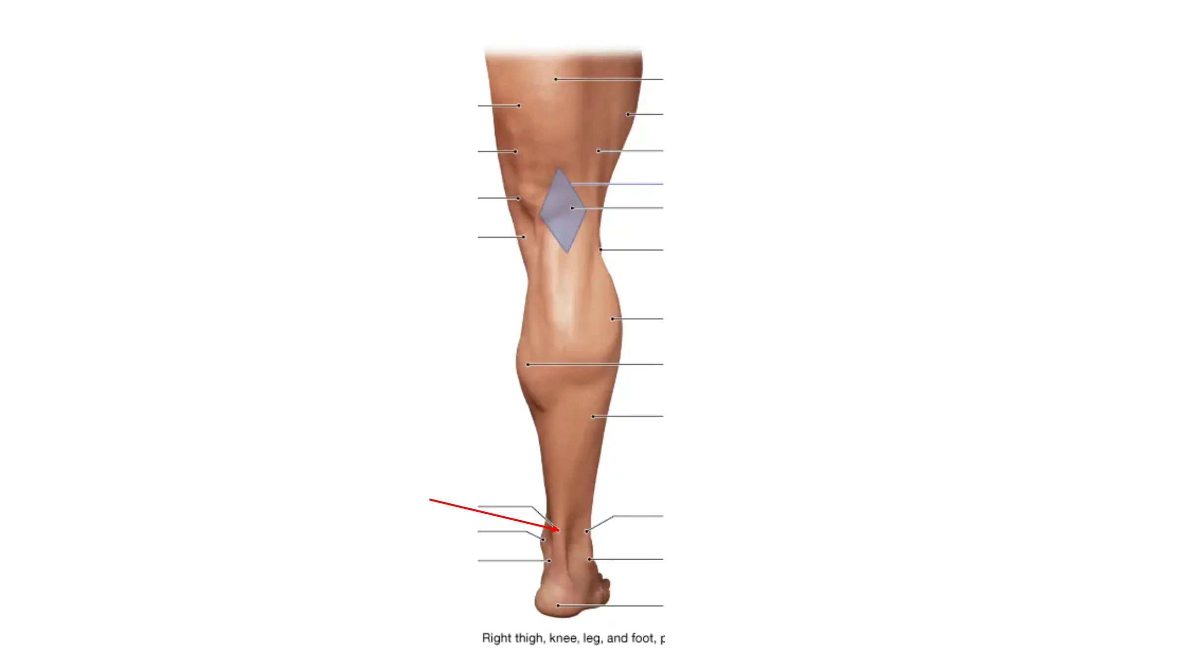 term image