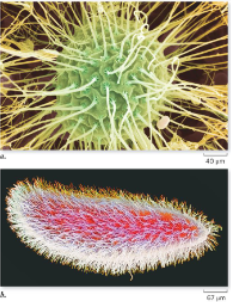 <p>Microtubule-based cellular projections that extend from the plasma membrane to facilitate cell motility or move fluids across the cell surface</p><ul><li><p>Made of microtubules (only in eukaryotes)</p></li><li><p>Cilia shorter and more numerous</p></li><li><p>Cilia only in eukaryotes</p></li><li><p>Flagella: a long, whip-like cellular appendage primarily responsible for locomotion in various prokaryotic and eukaryotic cells</p></li></ul><p></p>