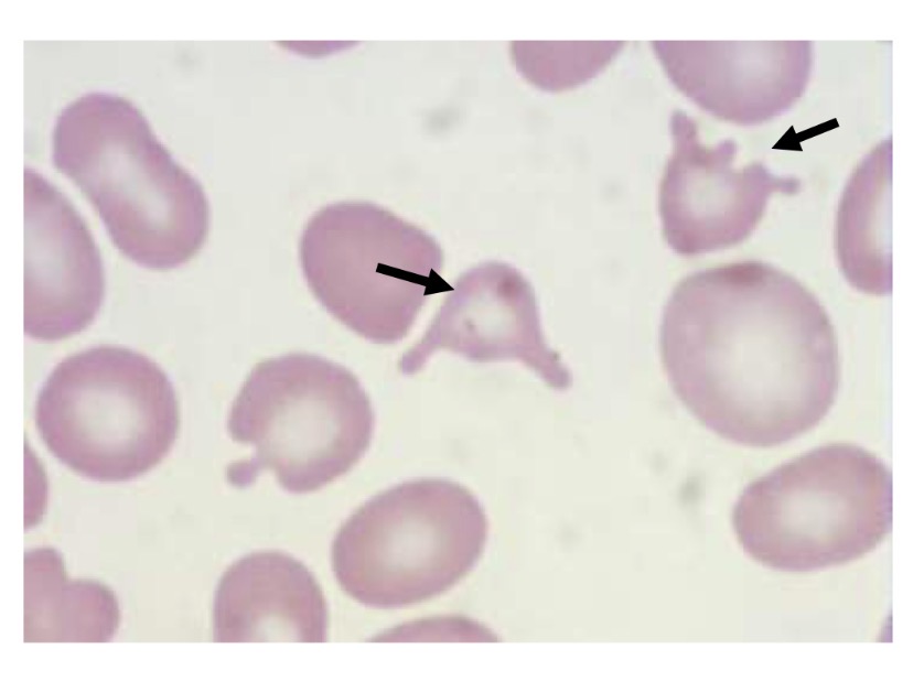 <p>Name this type of RBC</p><p></p>