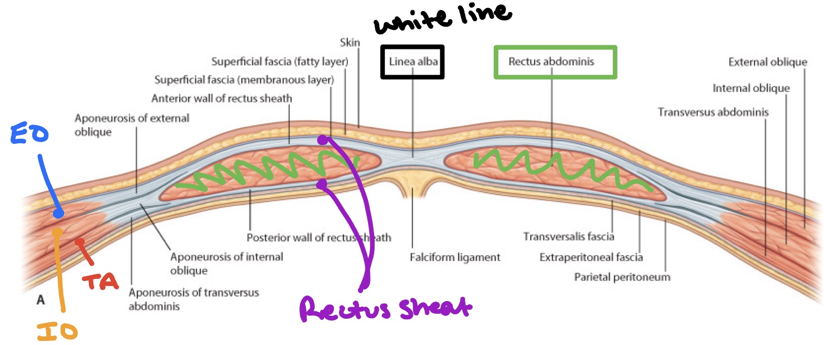 <ul><li><p>Aponeuroses of the 3 anterolateral abdominal wall muscles, forms the <span style="color: rgb(126, 45, 245);"><strong>anterior &amp; posterior rectus shee</strong></span>t (encloses rectus abdominis muscle)</p></li></ul><p></p>