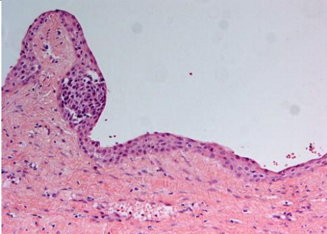 term image