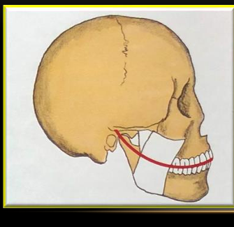 <p>-aligned so that a continuation of its arc would extend through the condyles</p><p>-curve of this arc relates on average with a 4 inch radius (or an 8 inch diameter) sphere</p>