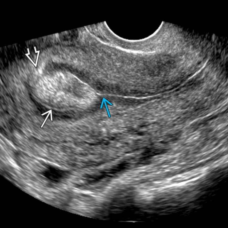 <p><span>What pathology are we seeing in this image?</span></p>