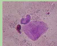 <ul><li><p>distal urethra, vagina, vulva, or prepuce</p></li><li><p>not significant </p></li><li><p>flat, thin </p></li></ul><p></p>