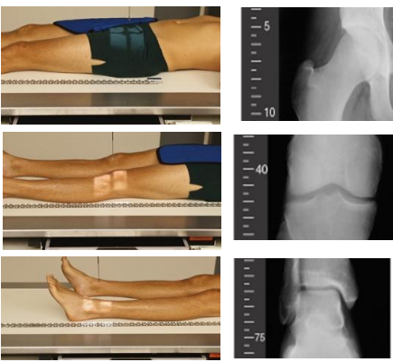 <p>AP hip</p><p>Ā»Direct the CR to a level 3/4ā above symphysis pubis </p><p>AP knee</p><p>Ā»Direct the CR to a level 3/4ā below apex of patella </p><p>AP ankle</p><p>Ā»Direct the CR to level of ankle joint</p>