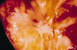 <p>star-like</p>