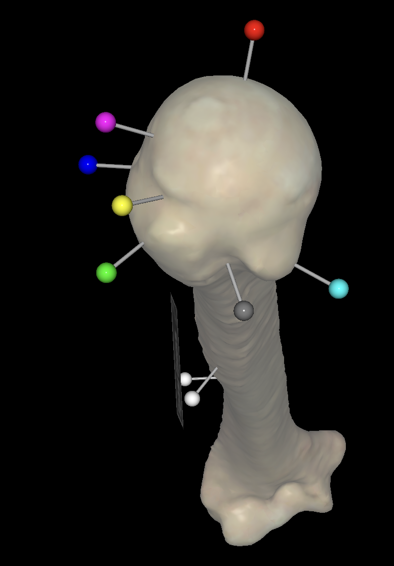 <p>What is the red pin called on the right humerus?</p>