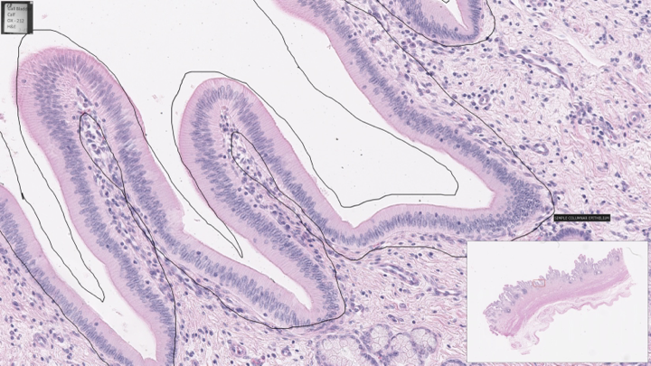 <p>simple columnar</p>