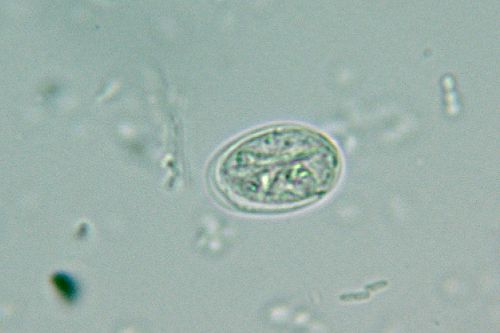 <p>Giardia</p>