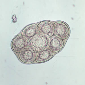 <p>– Round</p><p>– Thin shelled</p><p>– Oncosphere with six hooklets</p>