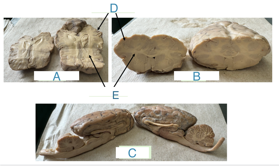 <p>C (what plane)</p>